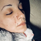 Livingeyes from Nicosia | Woman | 41 years old | Cancer